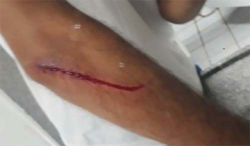 Estudante fere adolescente com estilete dentro de escola no interior de Alagoas