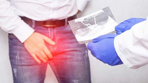 Coronavírus pode invadir testículos e causar inflamação, alerta estudo