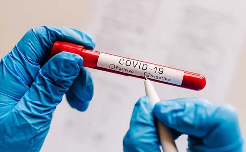 Covid-19: média de mortes no país atinge menor nível desde fevereiro