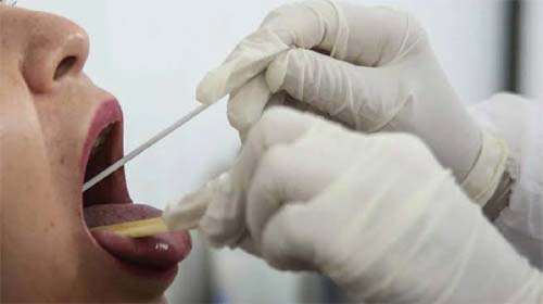 Judiciário inicia testagem de servidores para coronavírus nesta terça (1º)