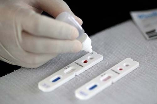 ANS torna obrigatória cobertura de teste de covid por planos de saúde