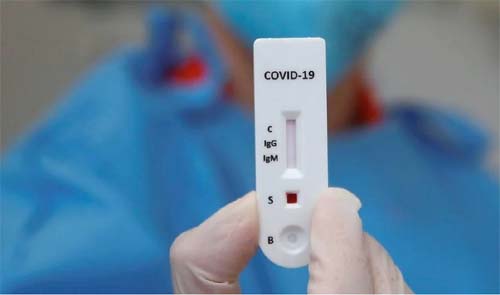Covid-19: Alagoas registra 475 novos casos e nove mortes nas últimas 24h