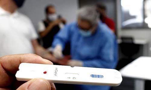 Após 15 funcionários testarem positivo para Covid, loja suspende atendimentos em Arapiraca