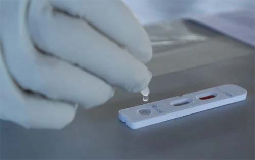 Número de testes positivos de Covid em farmácias de AL é o maior desde fevereiro