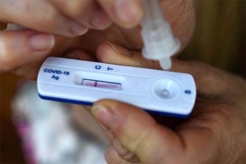 Covid-19: o que se sabe sobre a BQ.1 e XBB, subvariantes da ômicrom
