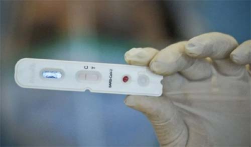 Mais 52 casos de Covid-19 e seis novas mortes foram confirmadas em Alagoas