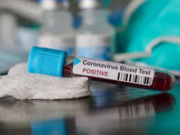 AL registra 298 novos casos de covid nas últimas 24h; mais 7 pessoas morreram