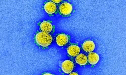 Brasil tem 35 casos confirmados da variante Ômicron
