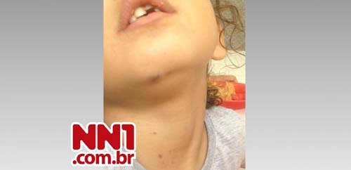 Pais denunciam agressões a criança de 4 anos em creche de Arapiraca