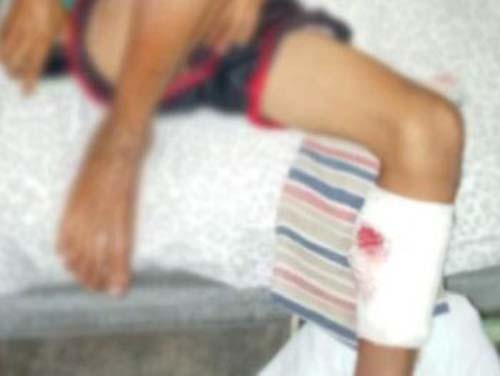 PM acusado de atirar em crianças relata que fazia uma perseguição após sofrer um atentado