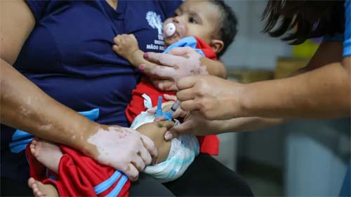 Casos de coqueluche aumentam no Brasil e levam a internações e mortes