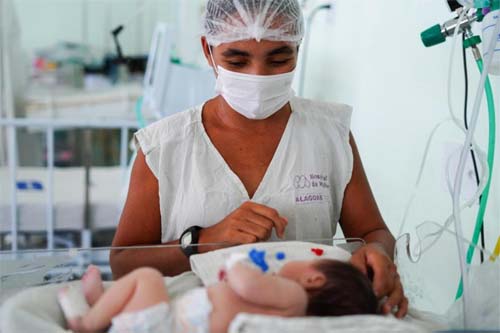 Projeto Respirar Transforma Vidas de 140 Crianças Traqueostomizadas em Alagoas