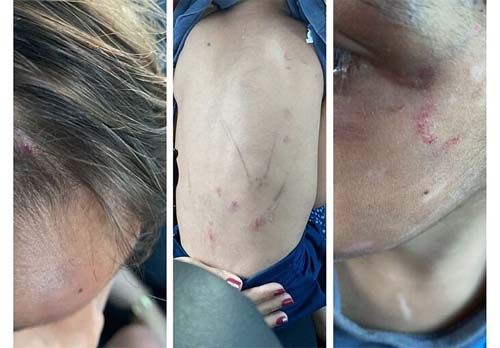 Justiça torna réu casal suspeito de espancar o próprio filho de 4 anos