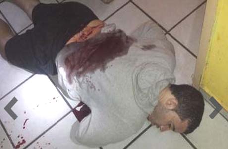 Jovem é executado a tiros na porta de casa no bairro Ouro Preto em Arapiraca