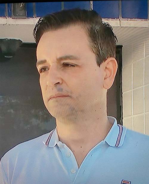  Mulher tem parte do rosto arrancada após reagir a assalto em Maceió