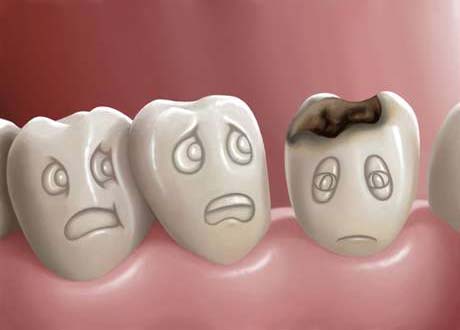 Um terço da população mundial sofre com problemas dentários