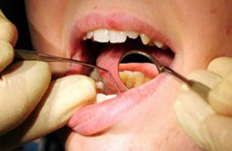 Cientistas britânicos prometem tratamento dentário sem brocas