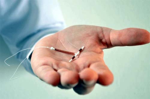 DIU: saiba mais informações sobre o método contraceptivo