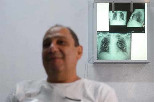 Gasto de Mais de R$ 25 Milhões em Nove Anos com uma Doença Pouco Conhecida no SUS