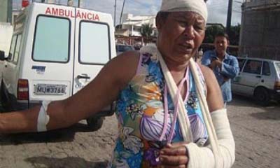 Mulher é espancada e finge de morta para escapar do marido