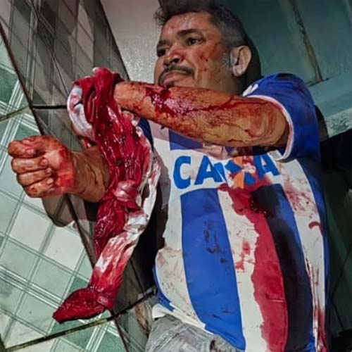 Briga entre parceiros de bebida em Ibateguara na Zona da Mata de Alagoas deixa duas vítimas e polícia prende suspeito