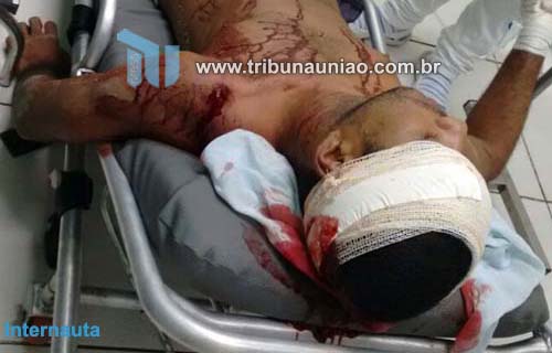 Companheiros de farra se desentendem e agricultor é agredido a golpes de facão em Branquinha