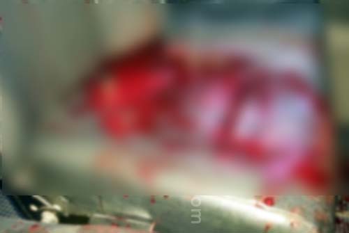 Militares sofrem emboscada e são atingidos a tiros na BR 316