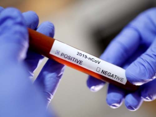 Em 24 horas, Alagoas registra 67 novos casos suspeitos de Covid-19