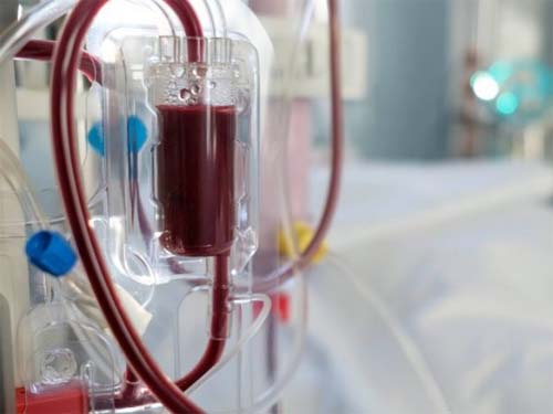 Nefrologia iniciará atendimento de hemodiafiltração on-line (HDF)
