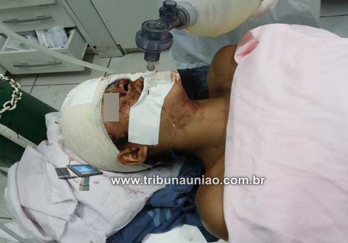 Faleceu no HGE terceira vitima do tiroteio ocorrido em 03 de maio na Fazenda Pindoba em União