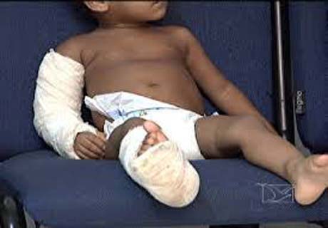 Polícia procura suspeito de espancar menina de 1 ano e 9 meses