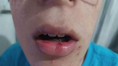 Estudante autista é agredido em ônibus quando voltava da escola no Rio de Janeiro