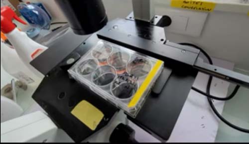 Cientistas franceses criam cópias de cânceres para testar moléculas em tumores resistentes