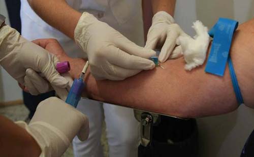 Exame de sangue pode detectar câncer oral 