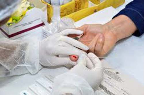 Estado de Alagoas regulariza a oferta de exames aos pacientes com HIV