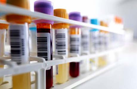Japão desenvolve exame de sangue para detectar 13 tipos de câncer