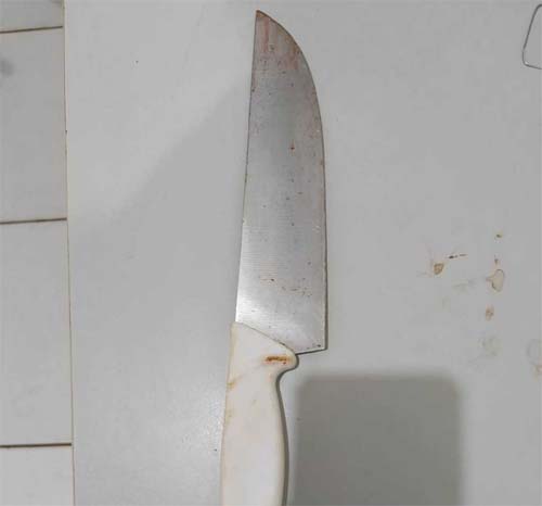 Caso foi registrado durante essa quarta-feira (28), no município de Limoeiro de Anadia, no interior de Alagoas.