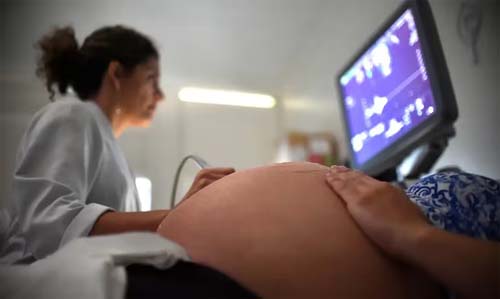 Brasil teve ao menos 31 bebês nascidos por dia de mães entre 8 e 14 anos nos últimos 5 meses