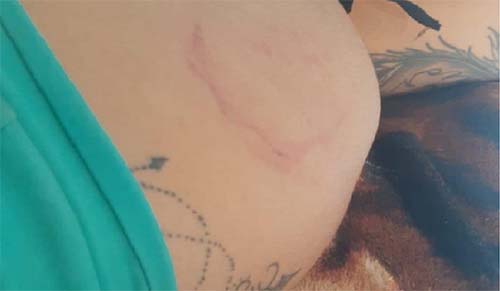 Grávida denuncia companheiro por homicídio e é agredida a tijoladas em Maceió