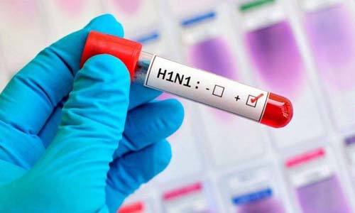 H1N1: Arapiraca registra três óbitos em dois meses