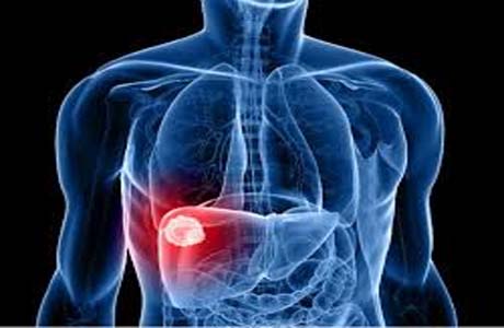 No Dia Mundial de Combate às Hepatites, especialistas alertam sobre a doença