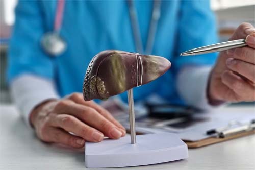 Hepatite D é classificada como cancerígena pela OMS