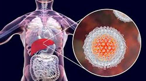 Hepatite: entenda as diferenças entre os cinco tipos virais