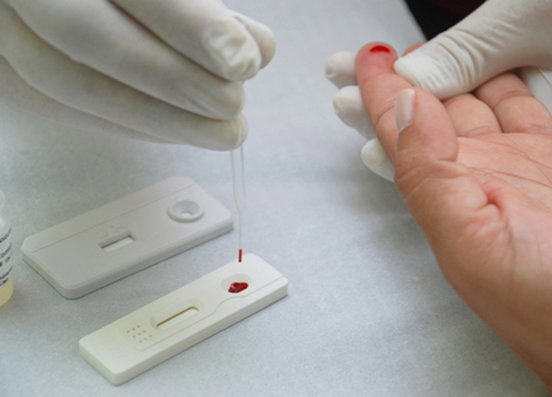 Julho Amarelo: campanha alerta para importância da testagem para hepatites virais