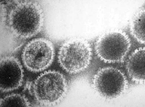 Vírus da herpes pode ser a causa do Alzheimer, diz neurobiologista