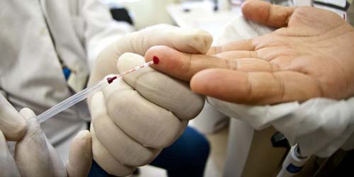 135 mil brasileiros vivem com HIV e não sabem