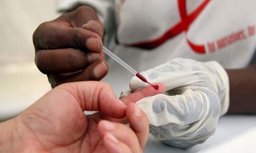 734 mil pessoas vivem com o vírus HIV no Brasil, mas só 589 mil sabem