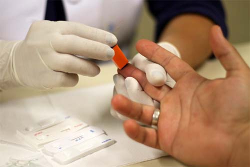 Estudo aponta que nova variante do HIV está circulando em pelo menos três Estados brasileiros