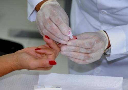 Ampliação de testes rápidos de HIV aumenta diagnósticos de Aids em Alagoas