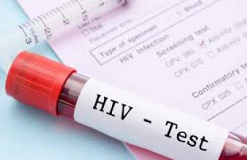 Gestantes com HIV podem ter filhos livres do vírus, diz Sesau